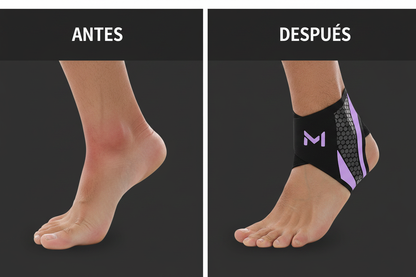 ErgoSox - Antes y después: tobillo inflamado vs tobillo sano con ErgoSox